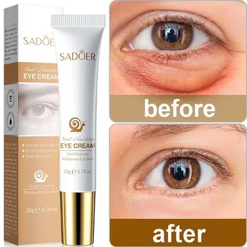 Snail Wrinkles Remover Eye Cream Anti-aging Puffiness Fade Fine Lines Remove Dark Circles Eye Bags Firming Moisturizing Eye Care - Thumbnail 2