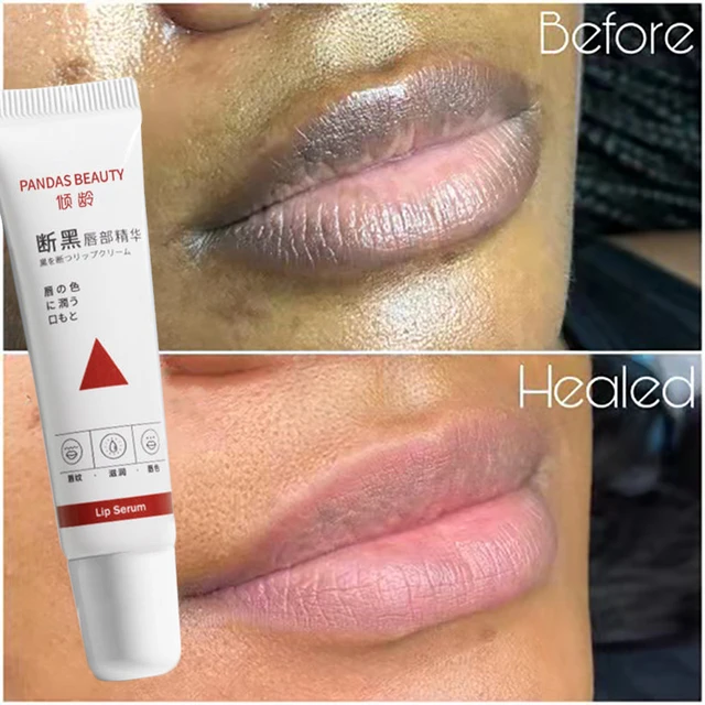 自然な口紅 ダークリップ 肌の輝き 色素沈着のための唇の血清 Aliexpress Mobile 自然な口紅 ダークリップ 肌の輝き 色素沈着のための唇の血清 Aliexpress Mobile