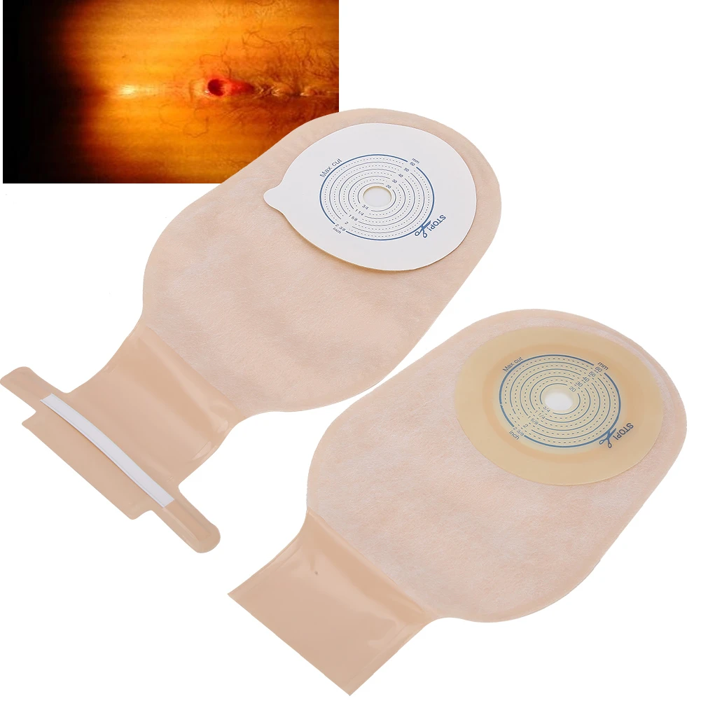 10pcs One Piece System Drainable Ostomy Bag Pouch Stoma Cover Urine 60mm Opening Ostomybagsdrain Valve Colostomy Stoma Care Aliexpress