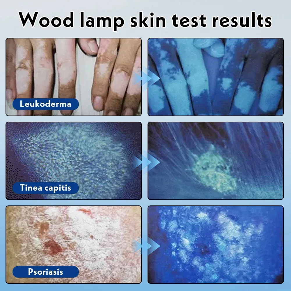 Veterinary Woodard Lamp 365nm UVA LED Light Source Pet Medical Wood lamp For Pet
