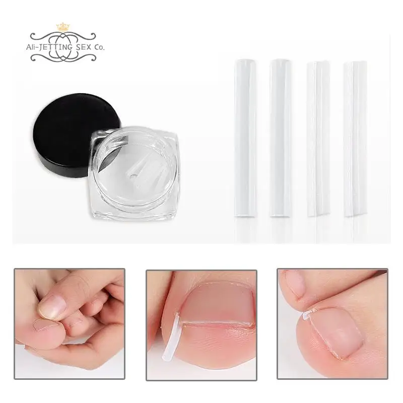 

10pcs Toenail Straightening Clip Ingrown Toenail Correction Nail Patch Sticker