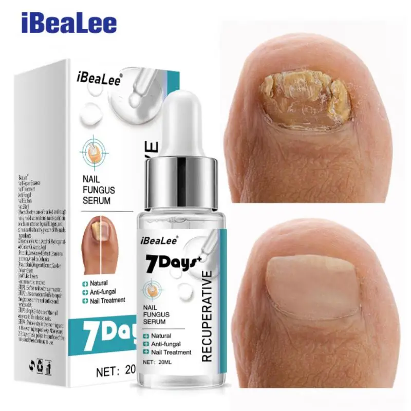 

iBeaLee 7DAYS Repair Nail Fungus Serum Foot Care Fungal Removal Repair Gel Anti-infective Onychomycosis 20ml