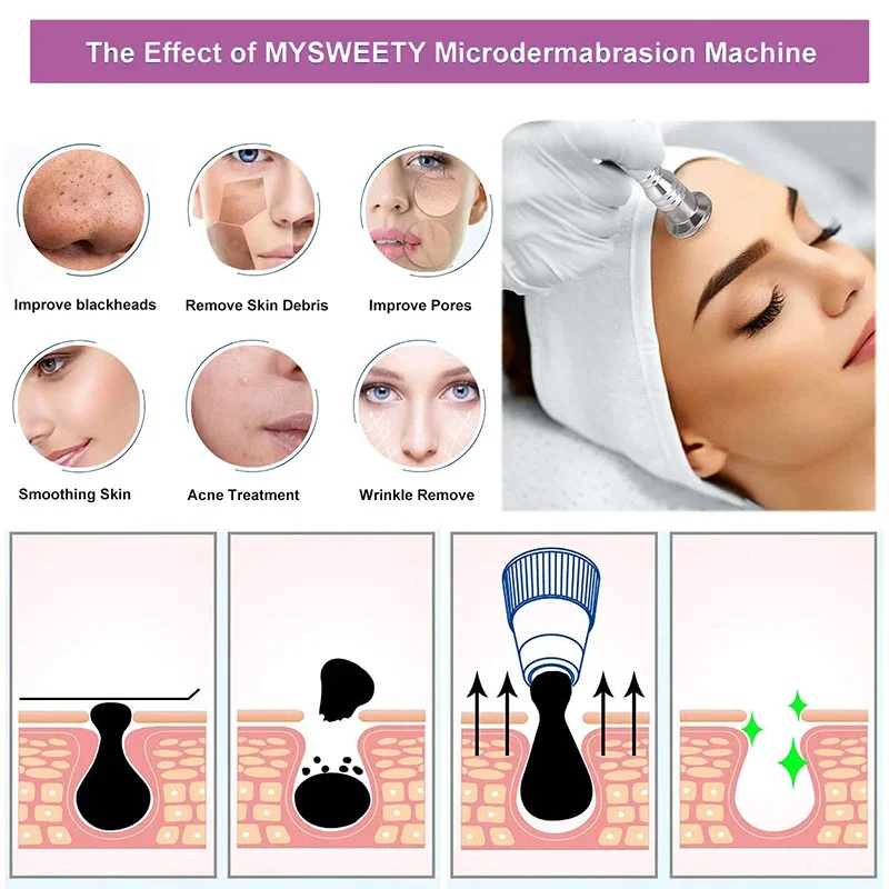 Diamond Skin Grinding Machine 3-in-1 Professional Beauty Microcrystalline Skin Grinding Equipment Vacuum High Suction Rejuvenation