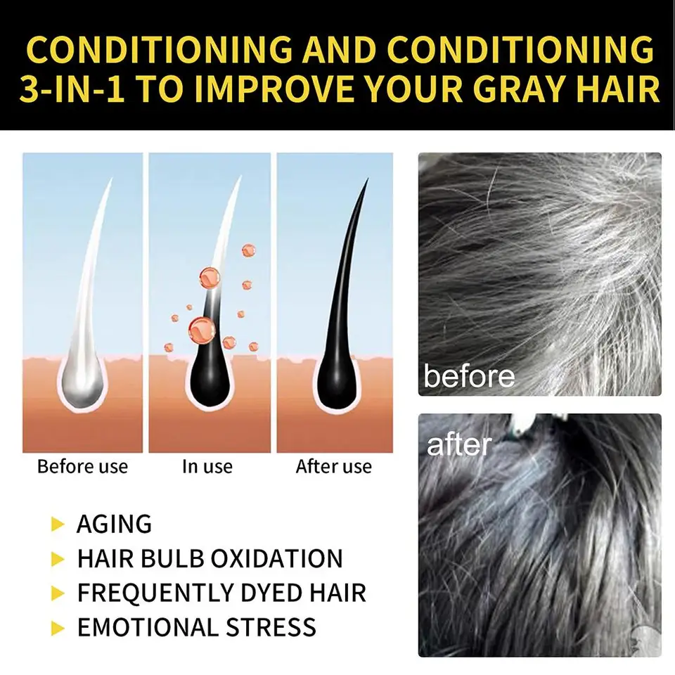 S023a1e8a496b418b965226fe9eff2