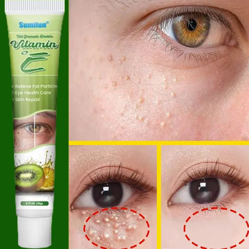 

Fat Granules Remover Eye Cream Improve Eye Bags Fade Fine Lines Moisturizing Anti-Puffiness Lifting Firming Eye Care Products