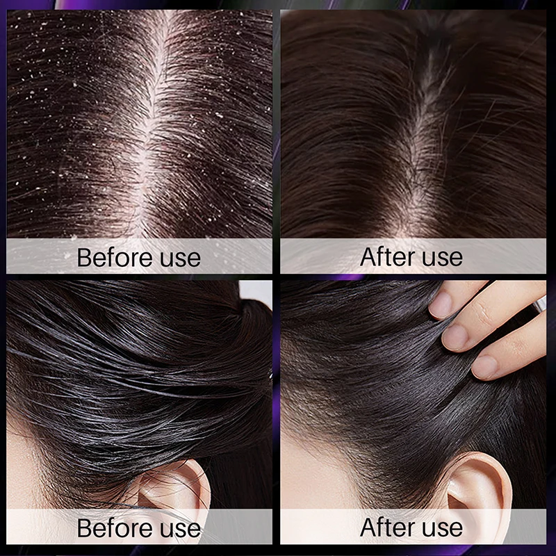 Hair Growth Thickening Shampoo Hair Growth Deep Cleansing Volumizing Shampoo Rosemary Onion Shampoo Hair Thickening Care Product 3