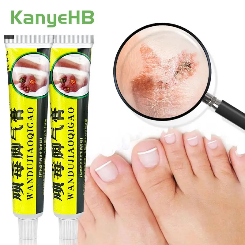 

2Pcs Beriberi Ointment Foot Odor Fungus Inhibitor Treat Tinea Pedis Relieve Foot Skin Itch Athlete Foot Peeling Herb Cream A1421