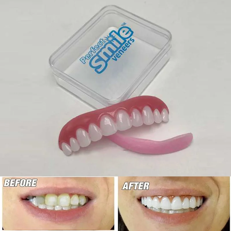 Sonrisa Carillas Cosmética Instantánea Reparación Dientes