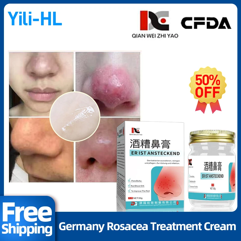 rosacea-treatment-germany-cream-face-shrink-pores-blackhead-acne