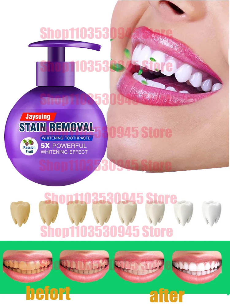 

Whitening Toothpaste Fight Bleeding Gums Toothpaste Prevent Tooth Decay Strengthen Teeth Gums Strong Baking Soda