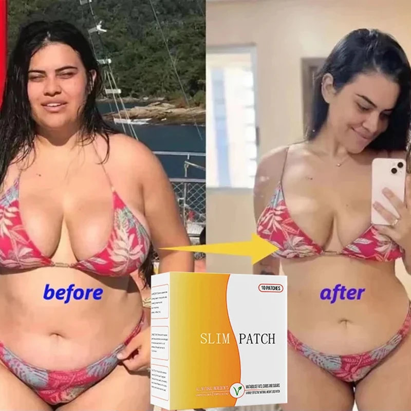 Abnehmen Nabel Anti Cellulite Verbrennung Fett Gewichts verlust Taille Bauch Diät Gewichts verlust dünne Oberschenkel 10 Stück magnetische Stein Color box