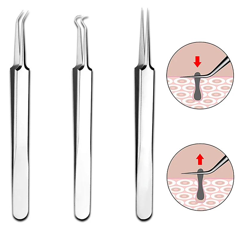 

8CM Cell Pimples Blackhead Clip Tweezers Beauty Salon Special Scraping Closing Artifact Acne Needle Tool