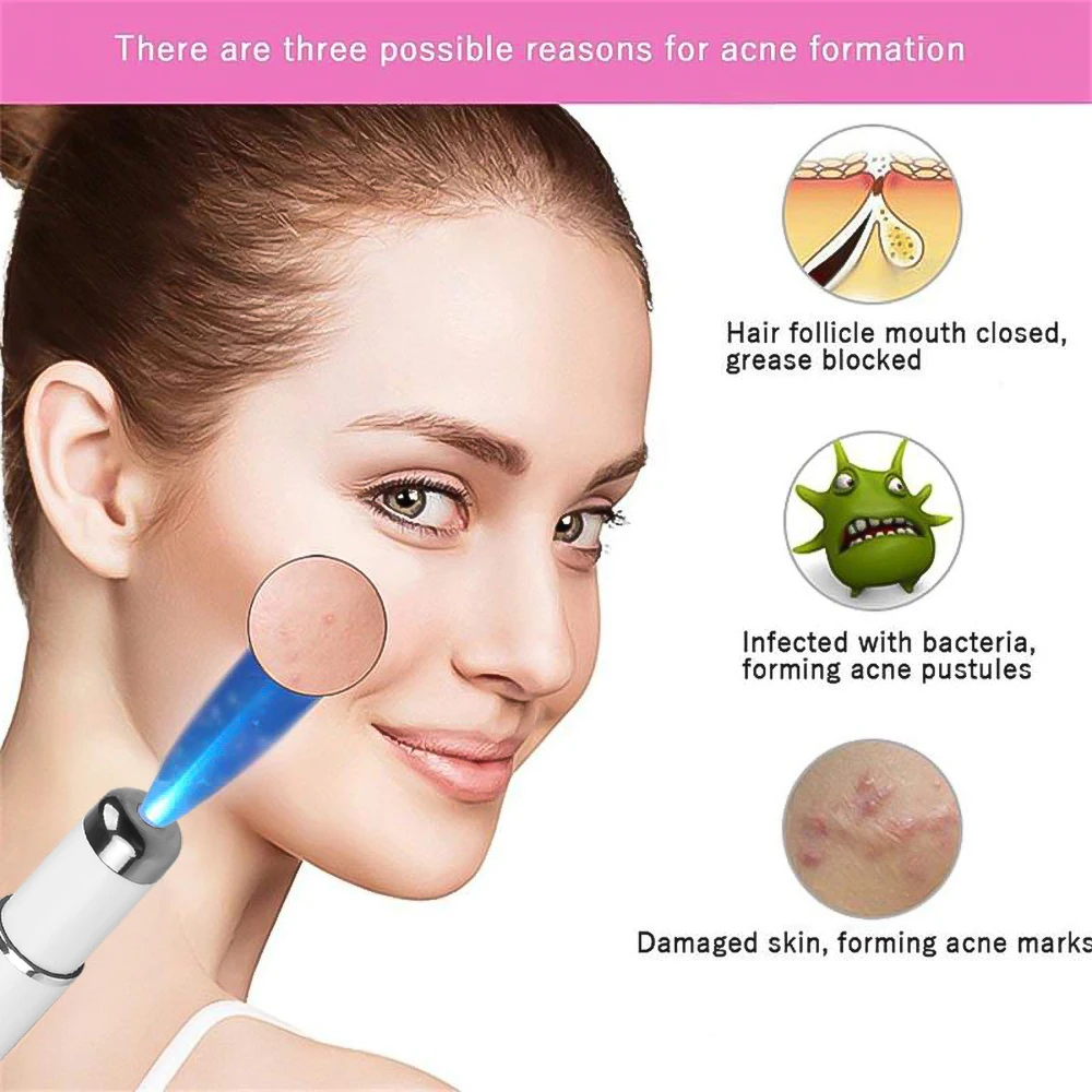 Portable Blue Light Reshaping Laser Pen Varicose Vein Treatment Scar Removal Tool Freckle Acne Treatment Beauty Tool electrotherapy skin care tool blue light therapy pen laser plasma pen remover laser pen therapy
