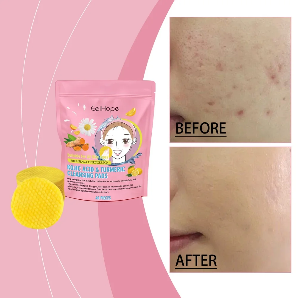 40PCS Kojic Acid Turmeric Cleansing Pads Unclog Pores Turmeric Kojic Acid Pads Face & Body cleansing pad