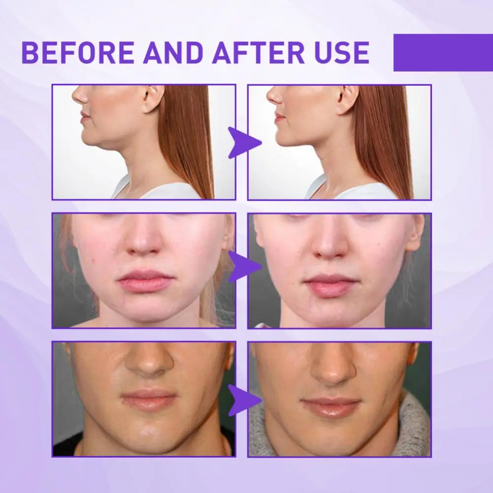 1/2pcs Face Cream Vface Slimming Jawbone Cream Slimming Cream To