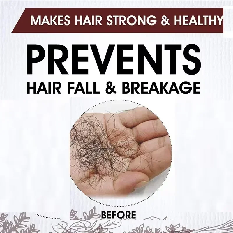 Effective Nurture Hair for Men Women Ginger Oil Care Anti Postpartum Hair Loss Scalp Treatment Serum Hereditary Products