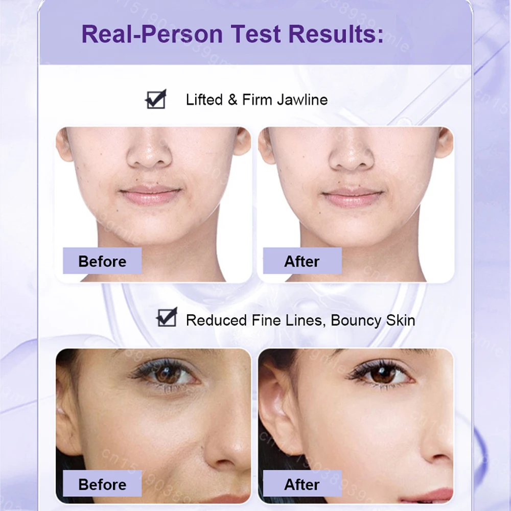 Ems Microcurrent Facial Device 4-Color Led Light Therapy Vibration for Skin Lifting Rejuvenation Skin Firming Face Beauty Device