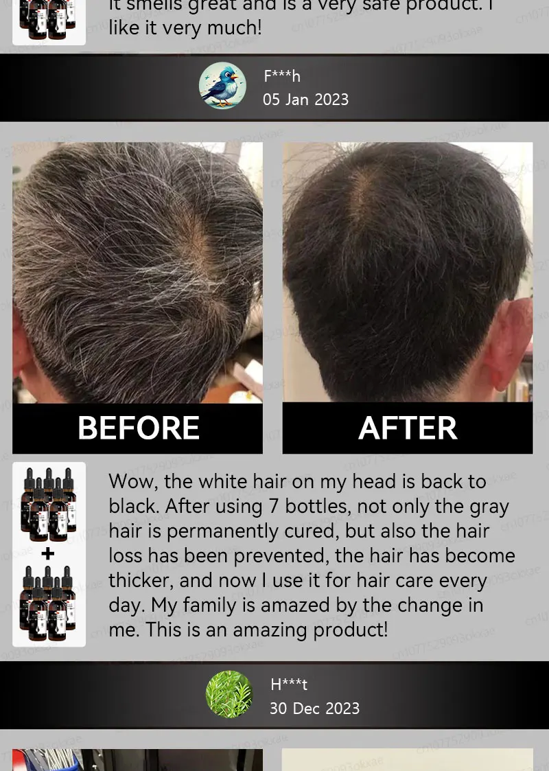 Description Picture 6 of itemGray Hair Treatment Serum White to Black Natural Color Repair Nourishing Products Anti-Hair Loss Care Men Women