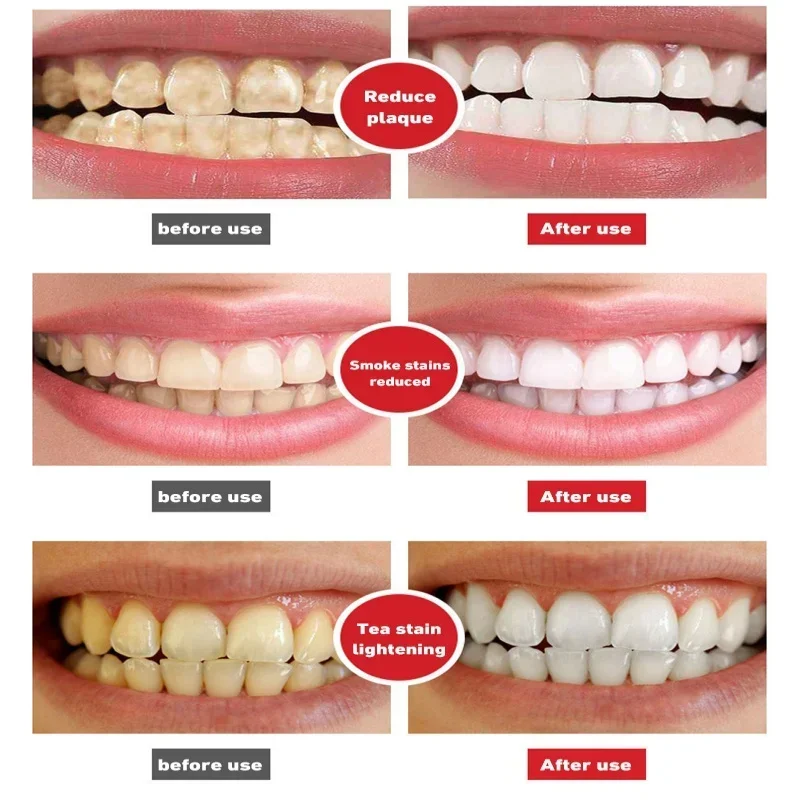 Probiotic Toothpaste Quick Repair Cavities Clean Whiten