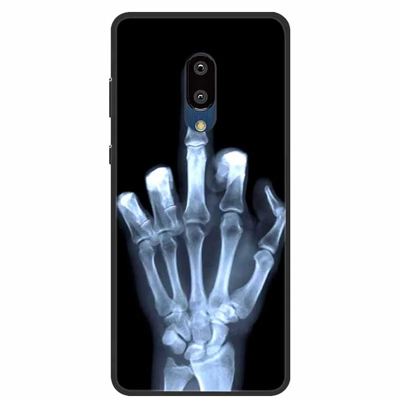 Custodia per Sharp Aquos S2 Borsa Protettiva Cellulare TPU