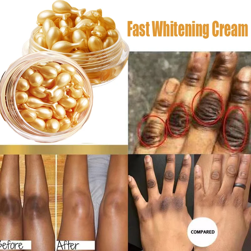 Whitening Serum Cream Fade Melanin Pigmentation Melasma Remove Dark Spots Anti aging Fade Fine Lines Brighten Korean Skin Care whitening body cream facial cream