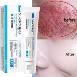 Instant Rosacea Treatment Face Cream Repair Redness Dry Sensitive Skin Improve Red Blood Cellulite Sooth Lotion Korean Cosmetics