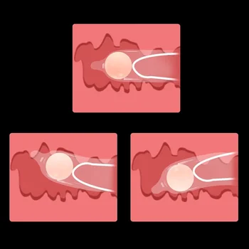 Reusable Silicone Beads Condoms Men Penis Enlargement Sleeve Intimate Goods Condoms Extender Ball Adult Sex Product Sex Toys 6