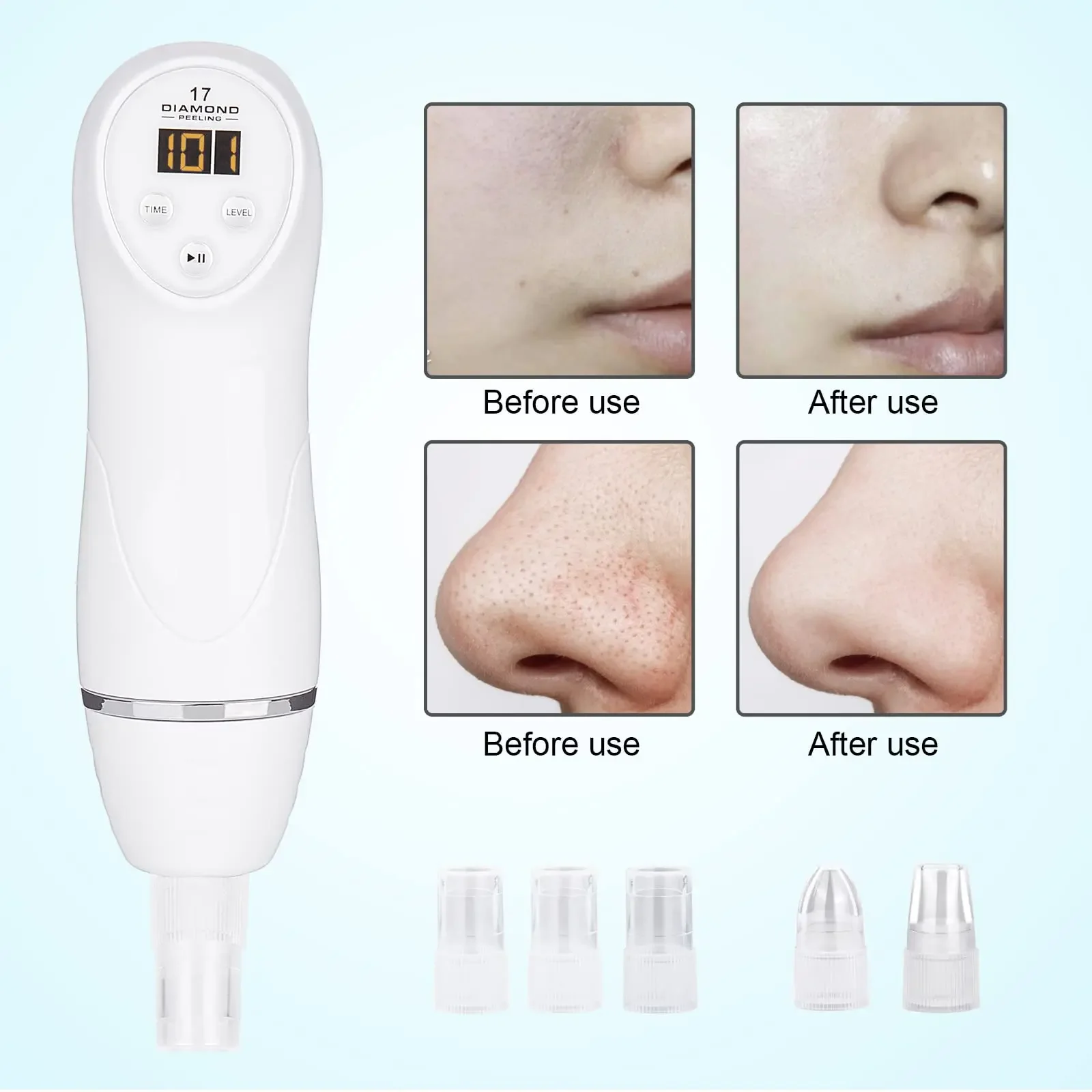 Diamond Microdermabrasion Machine Blackhead Remover Vacuum Facial Pore Cleaner Electric USB with 8 Probes Skincare Tool Home Use 3