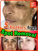 Effectively solves all pigmentation symptoms 1