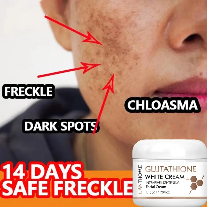 Glutathione Whitening Freckle Face Cream Remove Dark Spots Lighten Melasma Melanin Fade Acne Scars Anti-Aging_voghion.com
