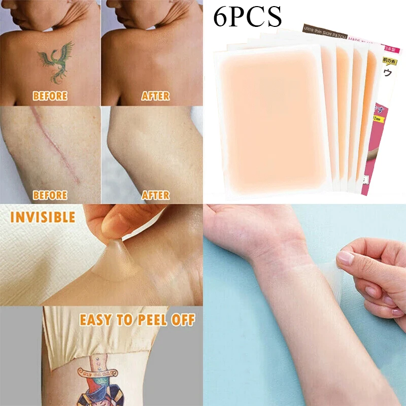 타투 모반 은폐 방수 흉터 컨실러 스티커, 휴대용 시뮬레이션 스킨 스티커, 피부 색상 커버, 6 개