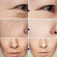 Retinol Wrinkle Removal Facial Kit Instant Firming Enhancement Anti Aging Serum Fading Fine Line Whitening Korean Skincare 2