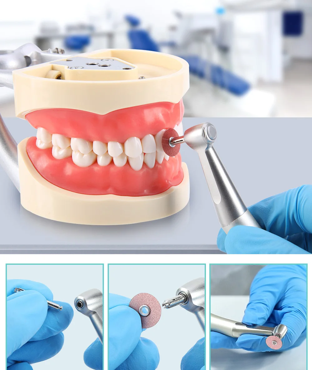 AZDENT 50 Stück Dental-Polierscheiben Superfein, Fein, Mittel, Grob für Komposite, Keramik, Glasionomer-Restaurationen – Detail 4