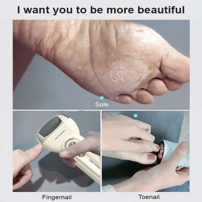 Home Foot Care Kit Electric Foot Grinder for Smoothing Rough Skin and Calluses 4