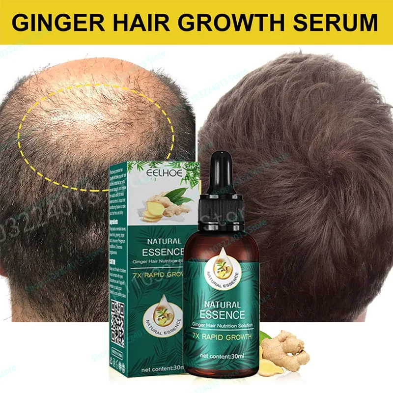 

Ginger Hair Growth Spray Serum For Anti Hair Loss Essential Oil Products Fast Treatment Prevent Hair Thinning Dry Frizzy Repair