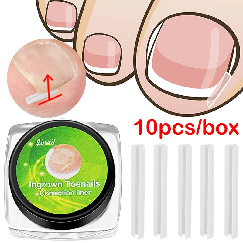 10pcs Ingrown Toenail Correction Tool  Straightening Clips Paronychia Correction Toe Nail Treatment Strip Brace Pedicure Tools