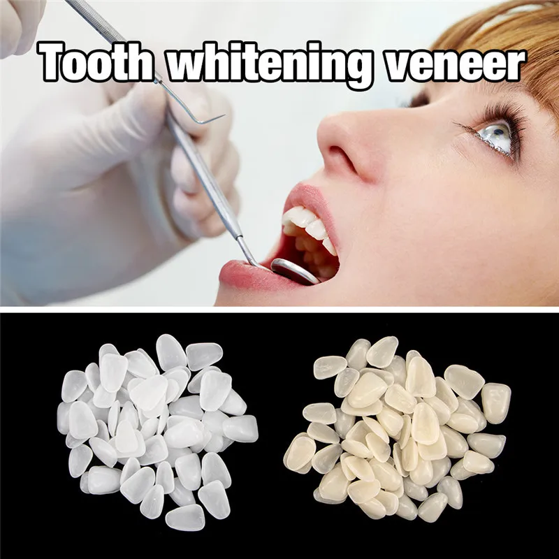 Dentes de resina dental folheados para cuidados