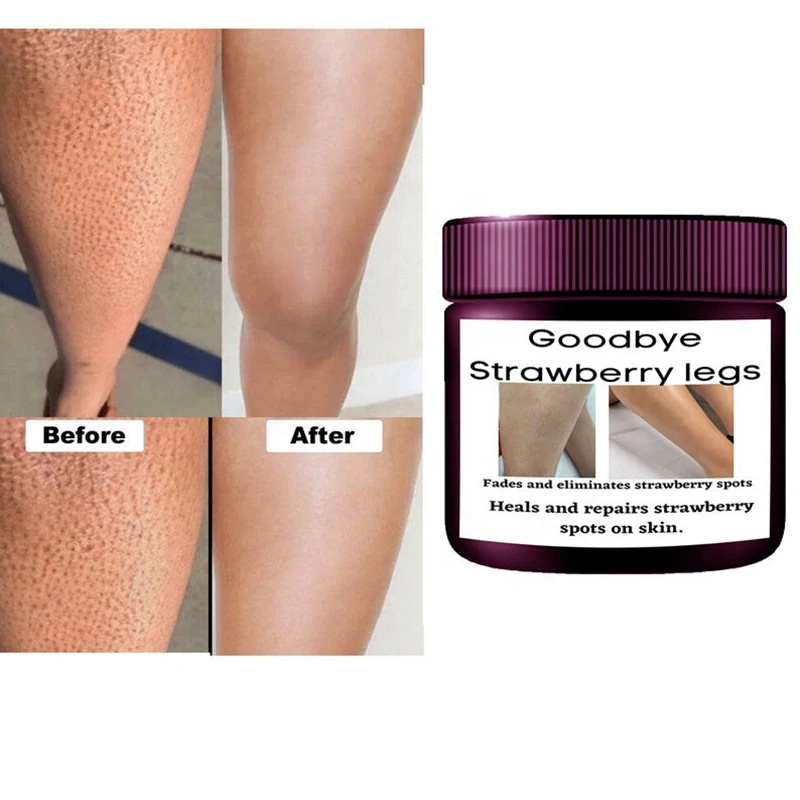 Strawberry Legs Cream Fades Strawberry Spots All Over Skin Smooth Strawberry Legs Exfoliating Cream Bleaching Cream for DarkSkin