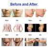 AOKO 2IN1 Tripolar Face Slimming Machine Facial Lifting Machine Body Face Massager Wrinkle Removal AntiAging Device 6