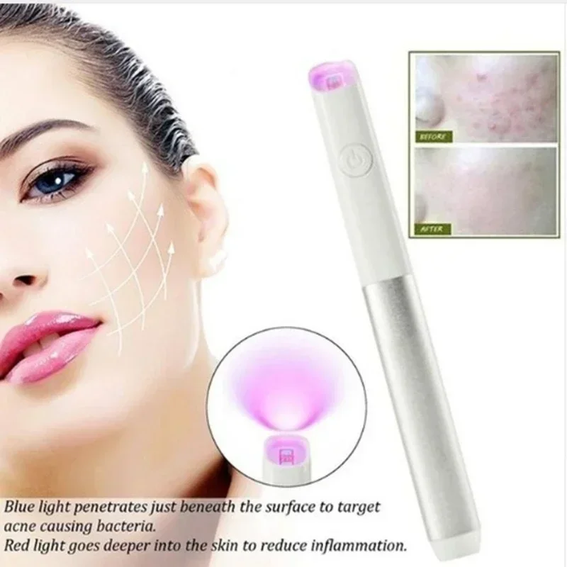 Beauty Instrument Portable Red Blue Light Therapy Face Acne Spot Treatment Pen Acne Scar Pimple Wrinkle Removal Pen