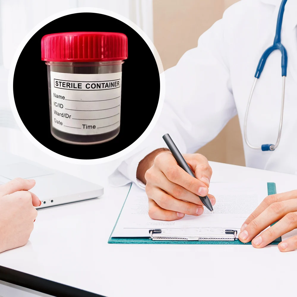 5pcs Urine Collection Sample Cup Specimen Bottle Container 60ML Plastic Cup Container for Use Disposable Urine