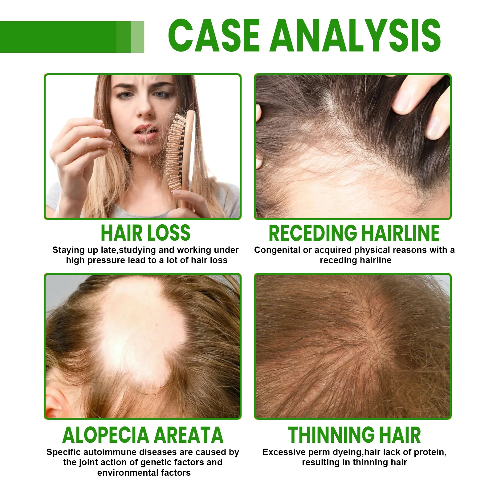 Rosemary Hair Growth Spray - Helps Strengthen Roots, Reduce Hair Loss, Nourish Dry Damaged Hair, Natural Essential Oil Treatment