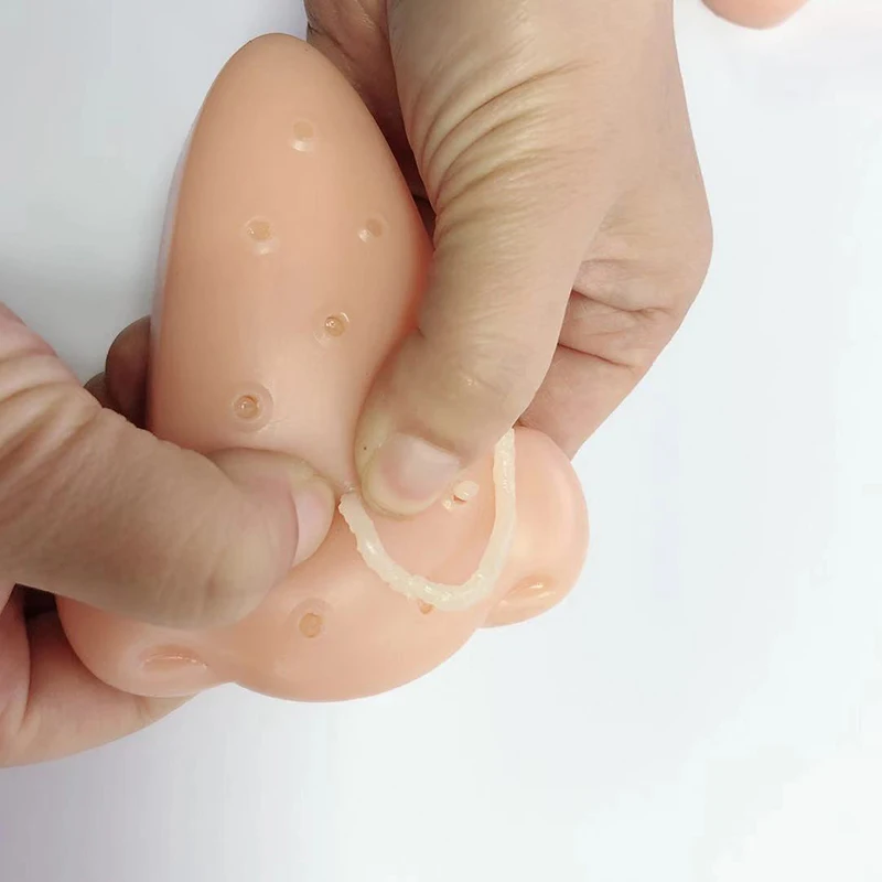 Pimple Popping Stress Relief Toy Spot Pimple Popping Toy Decompression Relief Nose stress relief toys