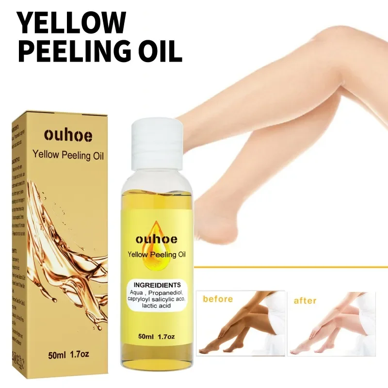 Yellow peeling oil exfoliating elbow knee Deep cleaning Bleaching fade Dark spots melanin brighten skin whiten Remove Dead skin whitening cream body scrub body peeling lotion