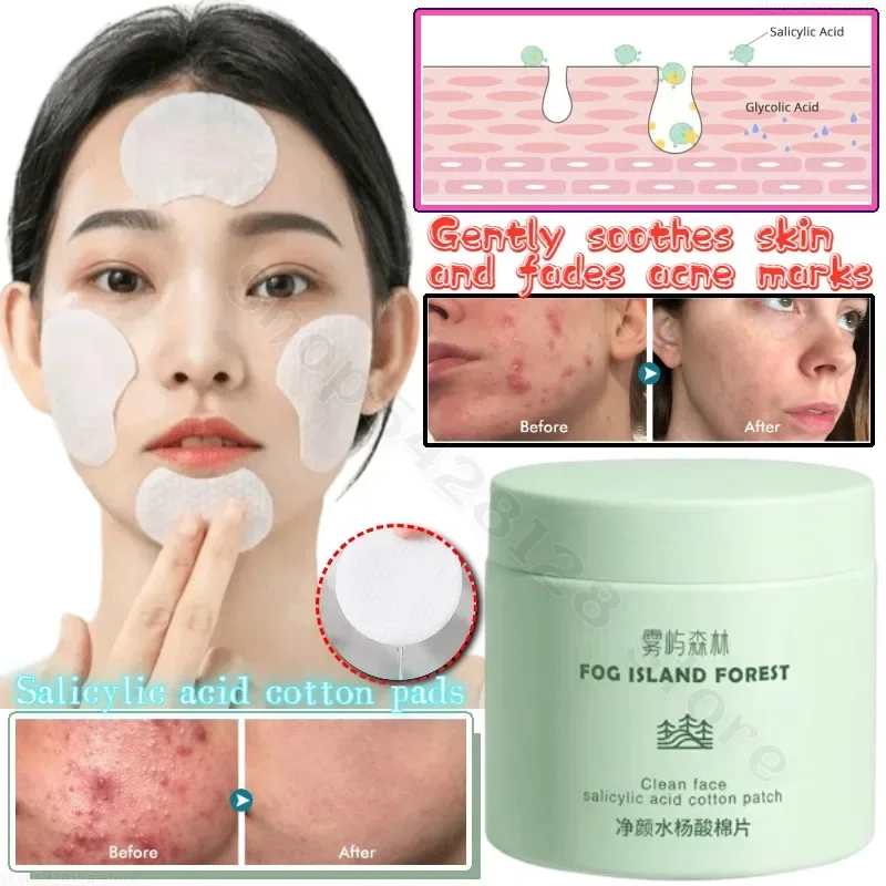 Salicylic Acid Cotton Pads Clean Shrink Pores Soften Cuticles Moisturize Brighten Fade Acne Marks and Soothe Sensitive Skin glycolic acid 30% acne removing cotton tablet oil control shrink pores moisturize and moisturize face clean