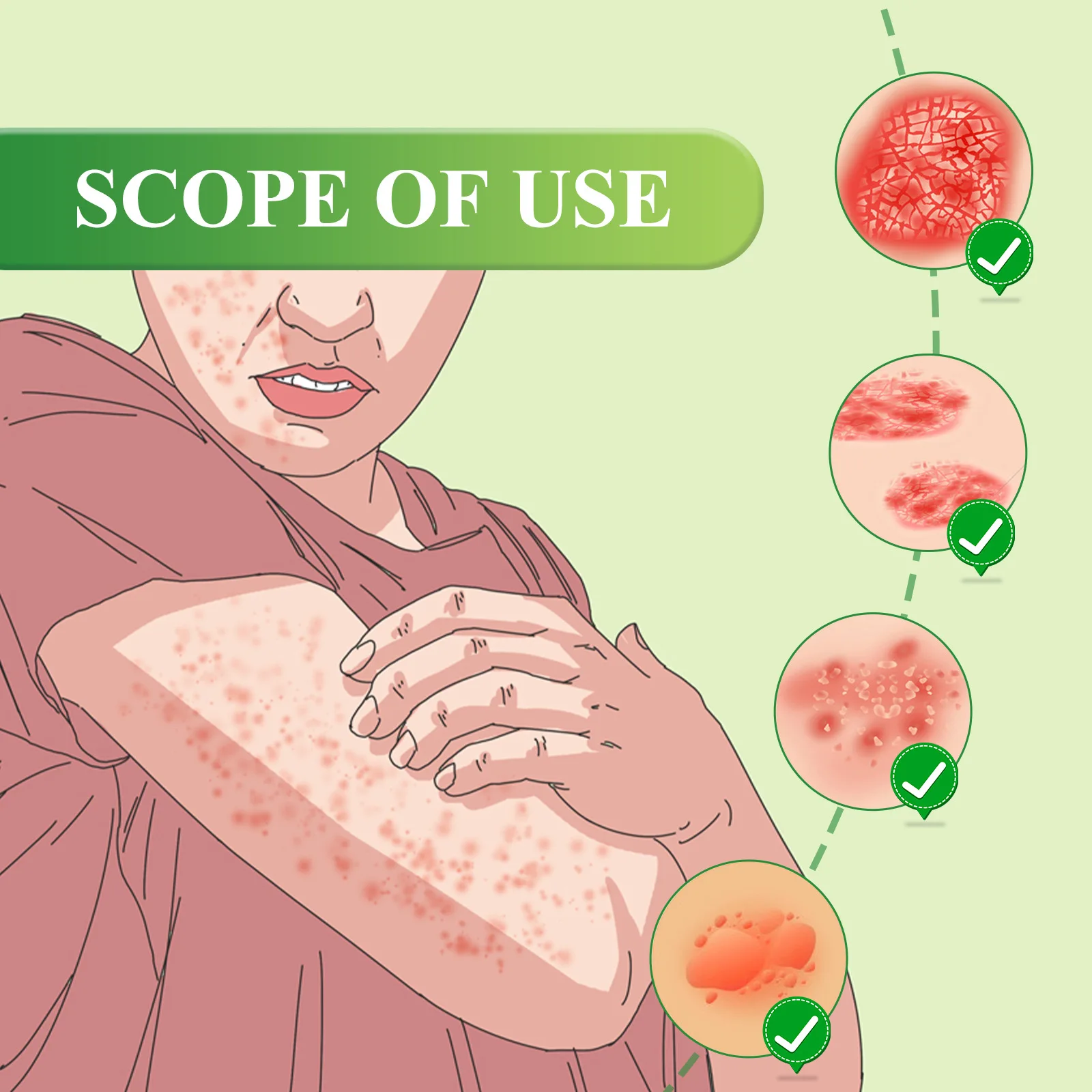South Moon Eczema Treatment Cream Anti Itching Remove Psoriasis Dermatitis Eczematoid Repair Skin Care Antibacterial Ointment
