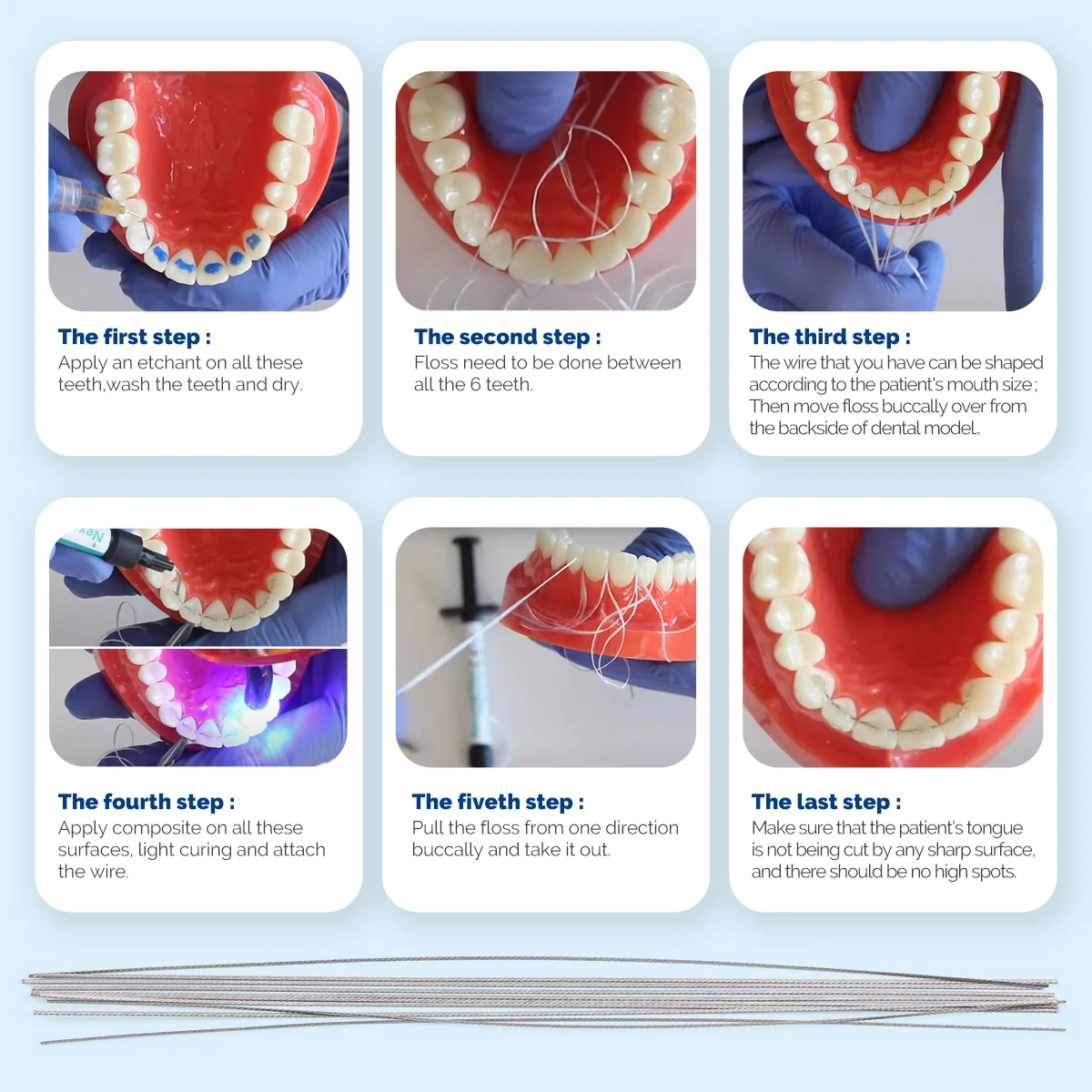 ワイヤー歯科矯正　TP Orthodontics TP オリジナルワイヤー | ティーピー・オーソドンテックス・ジャパン