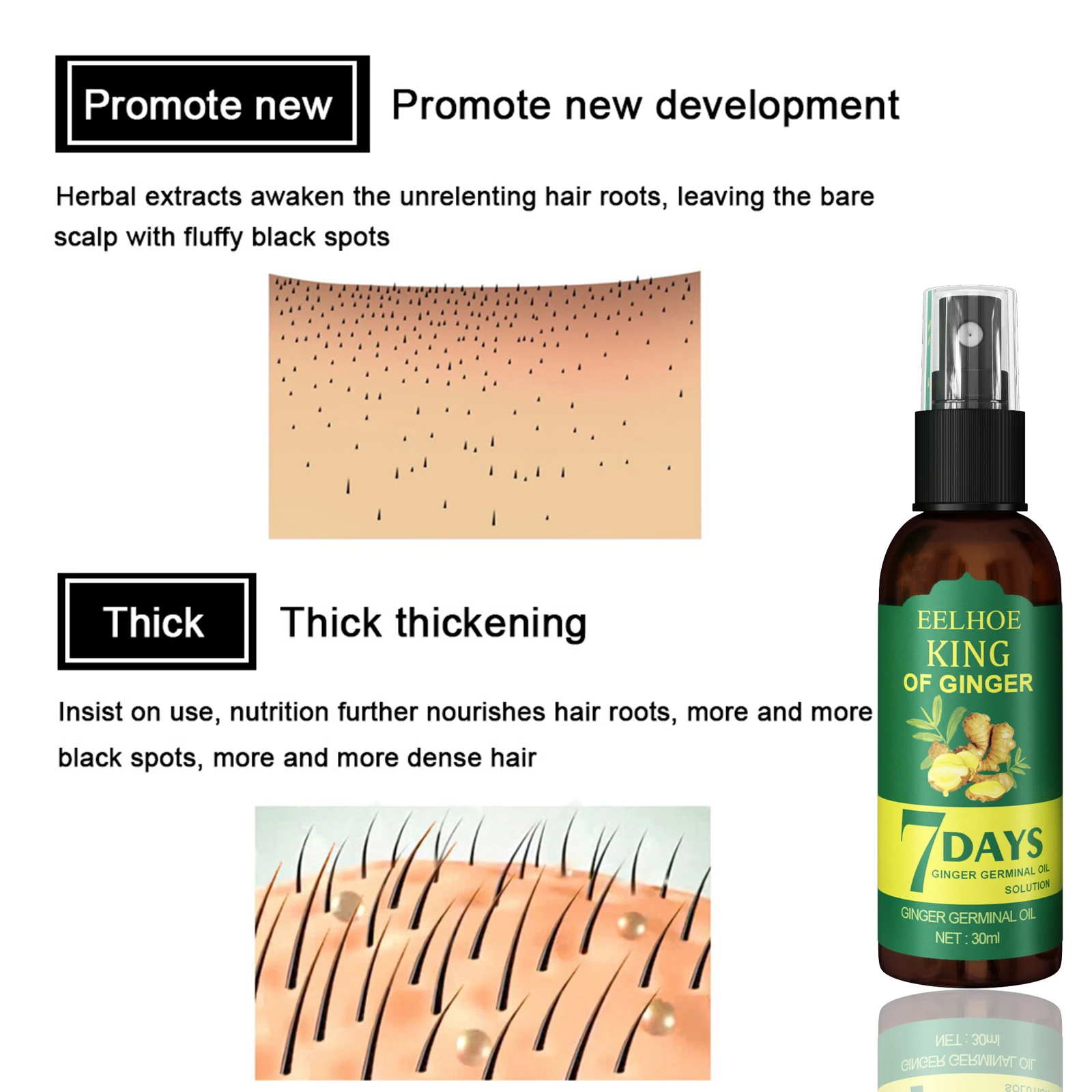 Ginger Care Hair Spray Nourish Hair Roots Massag Scalp RepairHair Growth Essence Quality Control Oil Care Solution