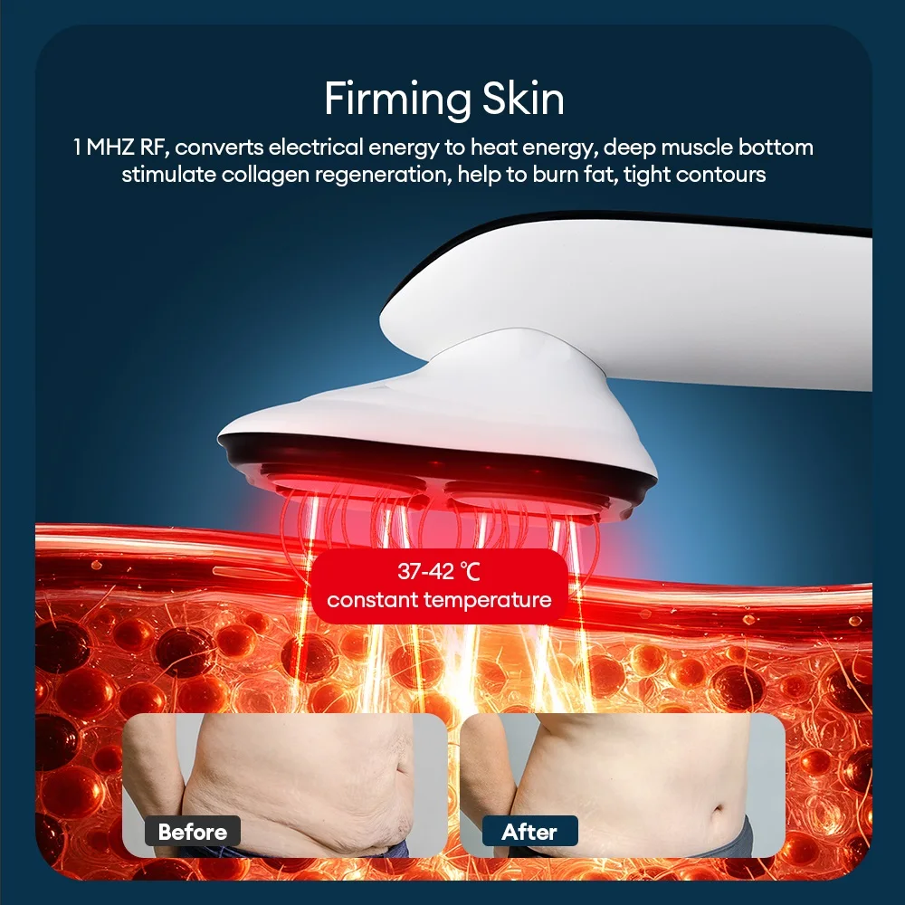 10 Gear Intensity Electric Fat Remover Body Massager EMS Microcurrent Cellulite Remover Massager For back Arms Waist Abdomen