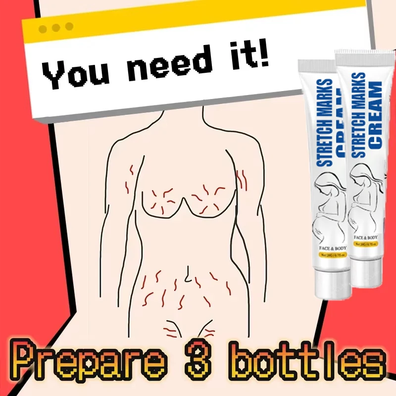 Fades commisted Marks and Special Skin Care emmes enceintes